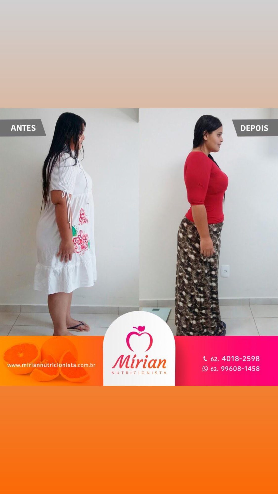 Antes e depois — paciente