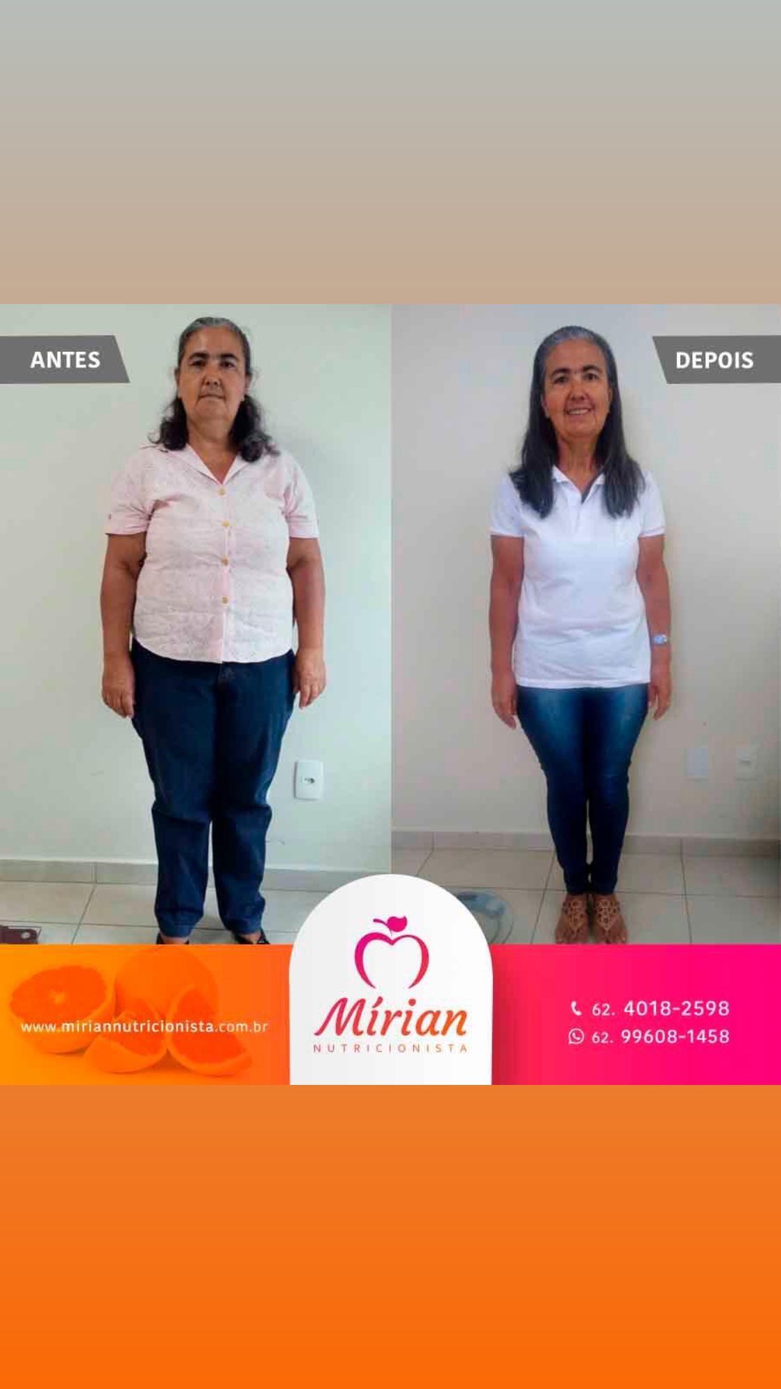 Antes e depois — paciente