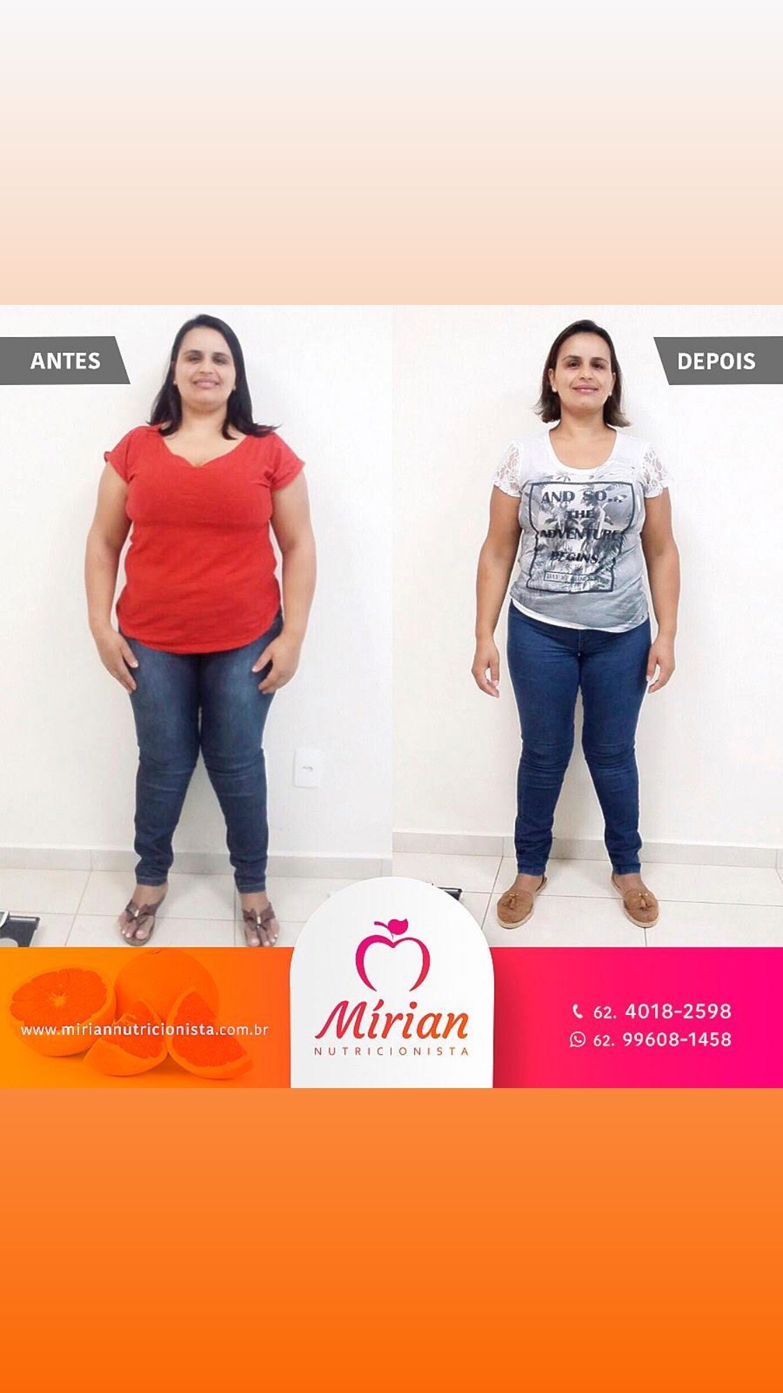Antes e depois — paciente