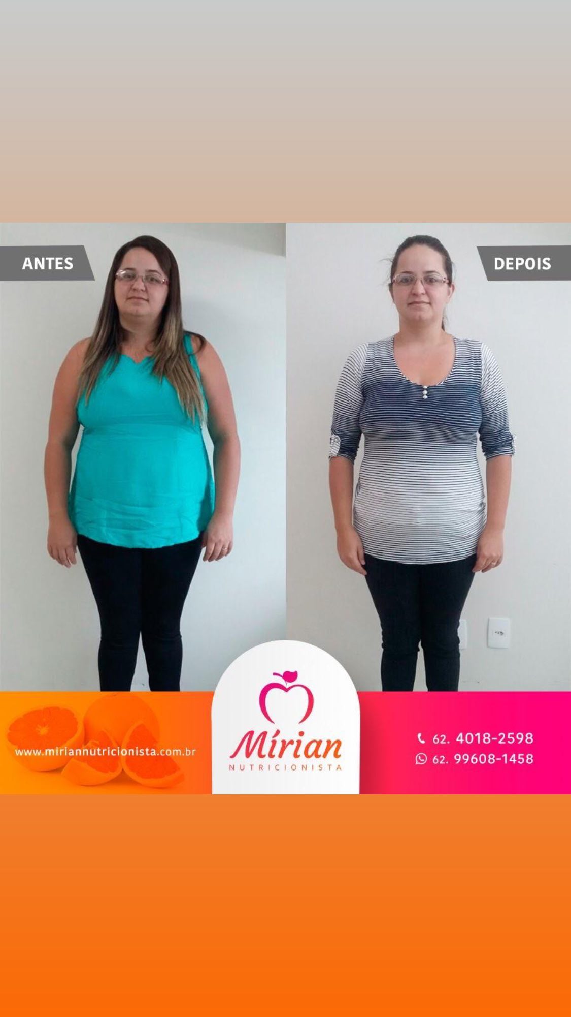 Antes e depois — paciente