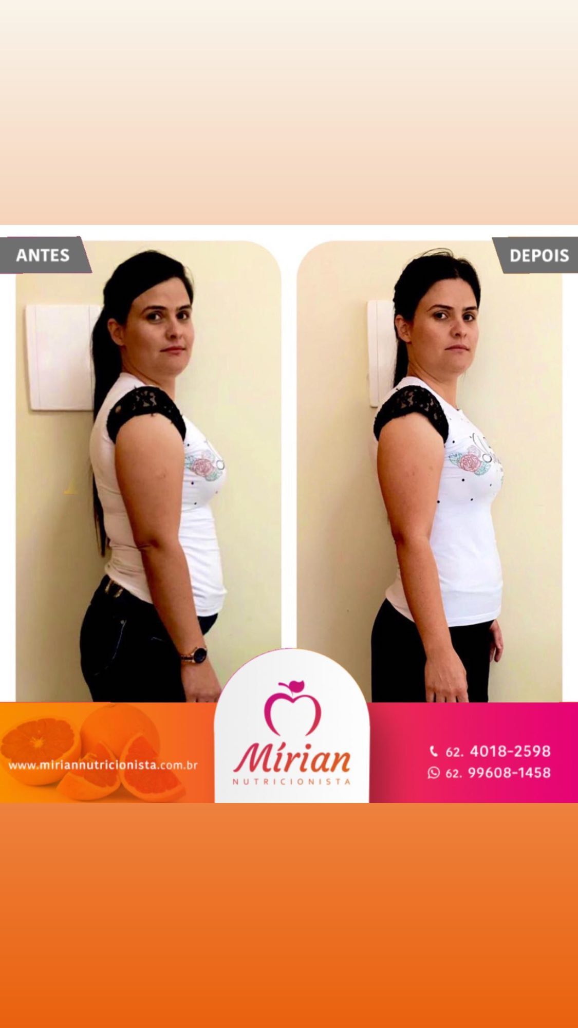 Antes e depois — paciente