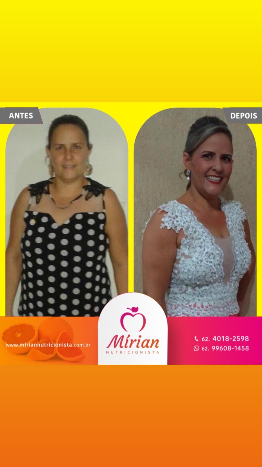 Antes e depois — paciente